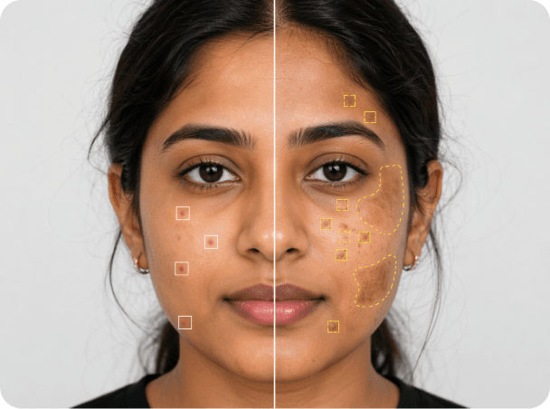 Side-by-side skin analysis comparison