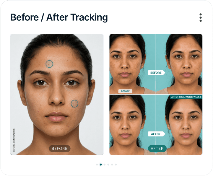 Before and after tracking mockup
