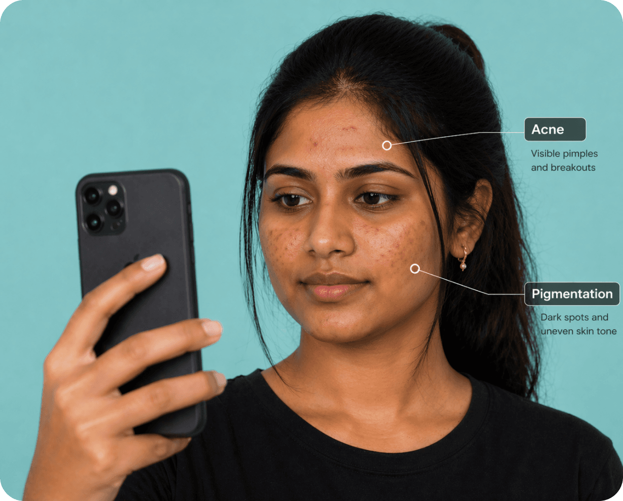Rupam.ai skin analysis result