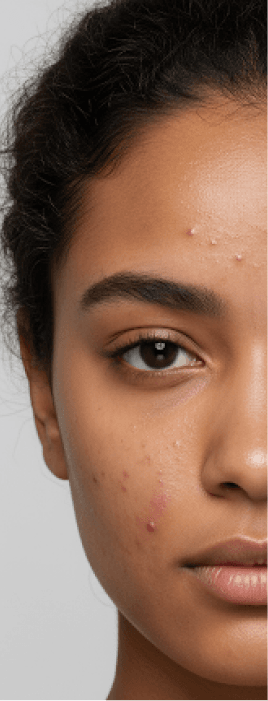 Bhartiya skin